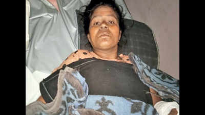 Gujarat: Another woman suffers mystery burns at Pirana