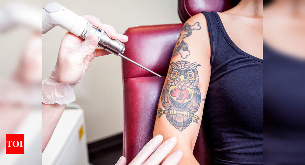 Laser tattoo removal in Nagpur – Nicelocal.in