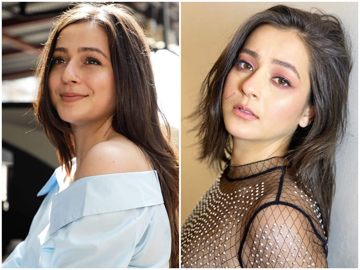 Priyal Gor Anarkali Diva Priyal Gor Flaunts The Scar On Her Face In This Body Positivity Post Malayalam Movie News Times Of India