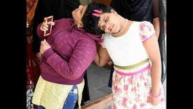 Hyderabad: Conjoined twins will have separate hall tickets for Class 10 board exam