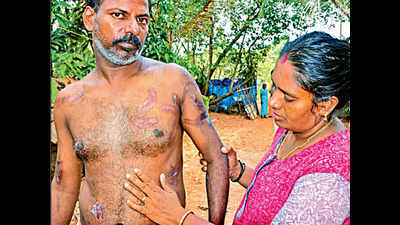 Man tortured in Malaysia returns home in Alappuzha