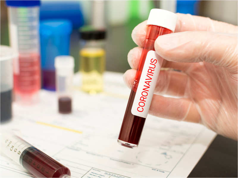 5 medical tests for coronavirus - Times of India