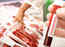 Coronavirus: Is it safe to eat meat and poultry?