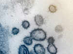 In Pictures: Up close with the coronavirus...