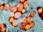 In Pictures: Up close with the coronavirus...