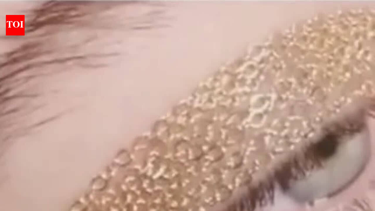 Chain eyes
