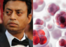 All about the cancer Irrfan was diagnosed with