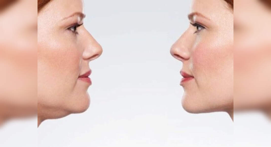 Best How To Look Your Face Fat with Best Haircut