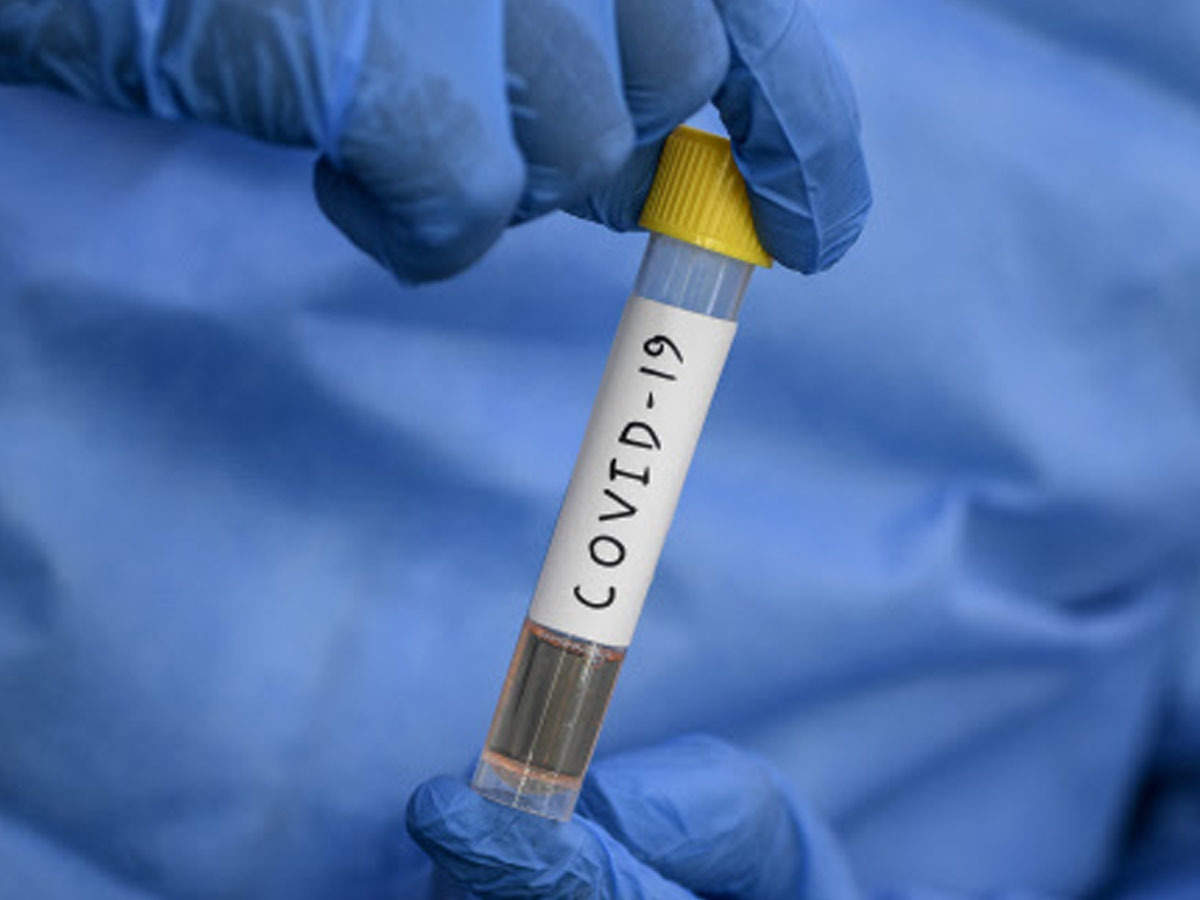 Chandigarh: Covid-19 testing kits to finish in two days at PGI | Chandigarh  News - Times of India