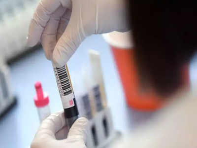 Four Covid-19 patients 'recover' after plasma therapy in Indore ...