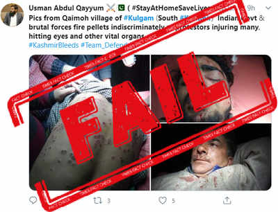 FAKE ALERT: Old, unverifiable photos from 2018 shared to claim pellet injuries to civilians in recent Kashmir operation