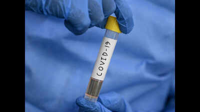 Five more succumb to Covid-19, 159 test positive in Pune