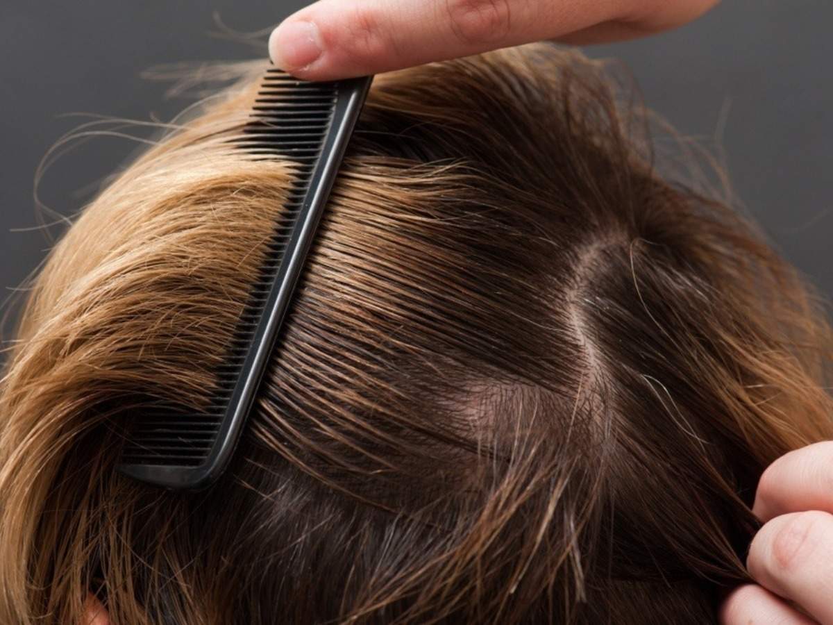 Best Hacks To Fix Greasy Hair Quickly