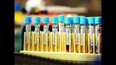 Meerut: 6 of 8 found Covid-19 positive by private lab test negative at government lab
