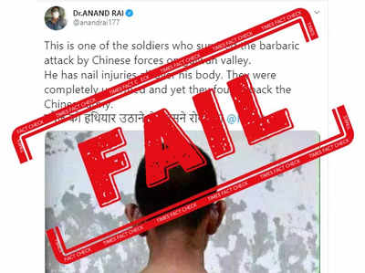 FACT CHECK: This viral image is not of injured Indian soldier in Galwan clash with China