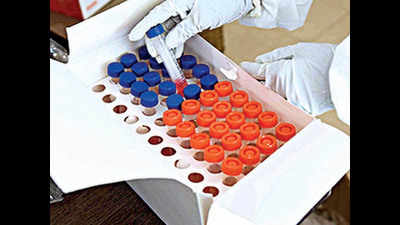 Covid test in pvt labs in Jharkhand to get cheaper