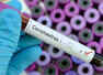 Antibody tests may help detect coronavirus infection if used at right time: Scientists