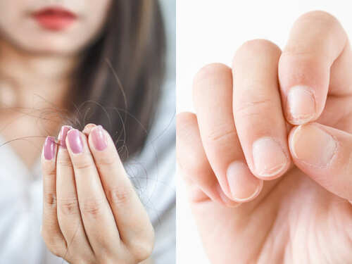 நகங்களை வலிமையாக்கும் உணவுகள்..! 1 6 foods to strengthen your hair and nails | The Times of India