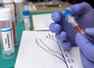 1 in 4 people in Delhi may have been exposed to COVID-19