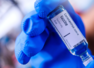 Coronavirus vaccine: Oxford vaccine human trials will begin next month in India, vaccine may be prized at ₹1,000 per dose