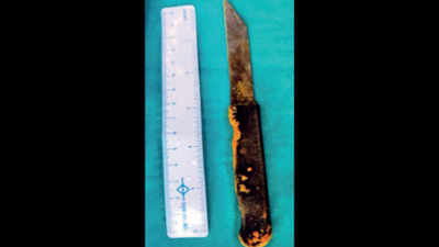 Delhi: Doctors remove 20cm-long knife stuck in a man’s liver