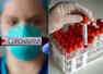 Plasma therapy: Some recovered COVID patients have richer antibodies than others, study finds