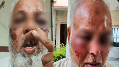 Rajasthan: Elderly muslim auto driver assaulted, forced to chant 'Jai Shree Ram' slogan