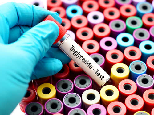 10 Simple Ways To Lower Your Triglyceride Levels The Times Of India 10 Simple Ways To Lower Your Triglyceride Levels The Times Of India
