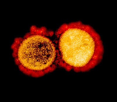 Ten times more infectious than Coronavirus: All you need to know about D614G