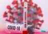 Coronavirus may go away in less than 2 years