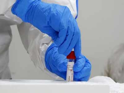 With 75,760 new cases, India's coronavirus count crosses 33-lakh mark