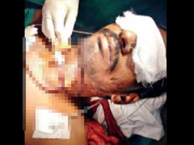 Ahmedabad: Doctors save voice of man who slit his own throat