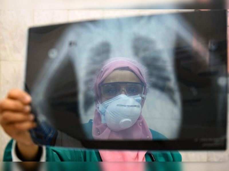 A doctor checks a patient's lung X-ray at a hospital in the capital Cairo (AFP)
