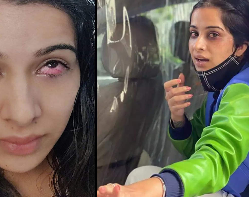 
Bigg Boss 14: Sara Gurpal's eye injury photos go viral after she gets evicted from the house
