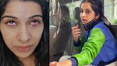 Bigg Boss 14: Sara Gurpal's eye injury photos go viral after she gets evicted from the house