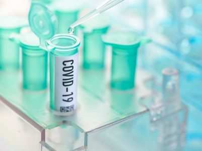 Nitric oxide a possible cure for Covid-19
