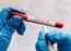 Millions more virus rapid tests, but are results reported?