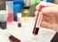 High levels of ultraviolet light 'most strongly' associated with reduced growth of COVID-19