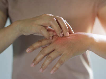 Skin rashes can be a symptom of coronavirus. Here is what you need to know