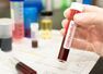 Coronavirus: Blood clots could be a possible cause for serious COVID-19 symptom, according to scientists