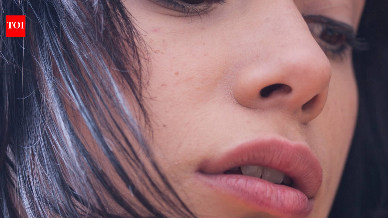 Everything you need to know about chapped lips