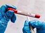 Why a negative test may not mean you are safe from COVID-19