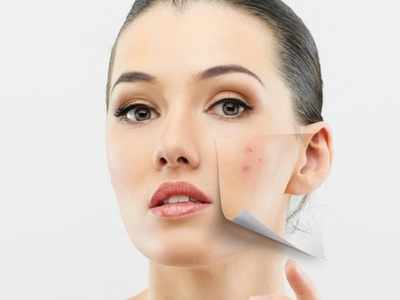 Anti-pigmentation creams: Get rid of pigmentation, dark spots, blemishes & more