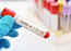 Covid-19: Scientists develop novel method to detect single virus particles