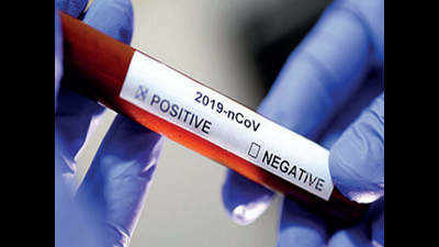 Vizag: Covid-19 severity may be lower among HIV patients, say experts