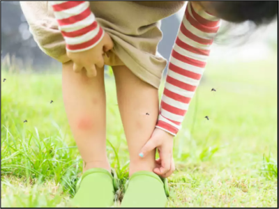 Mosquito repellent for kids: Effective after bite balms, lotions & more