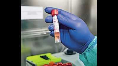 Telangana reports 609 new Covid-19 cases, 3 deaths; state to prepare frontline warriors' database for vaccination