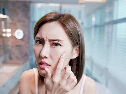 Quick and easy fixes for bad skin days