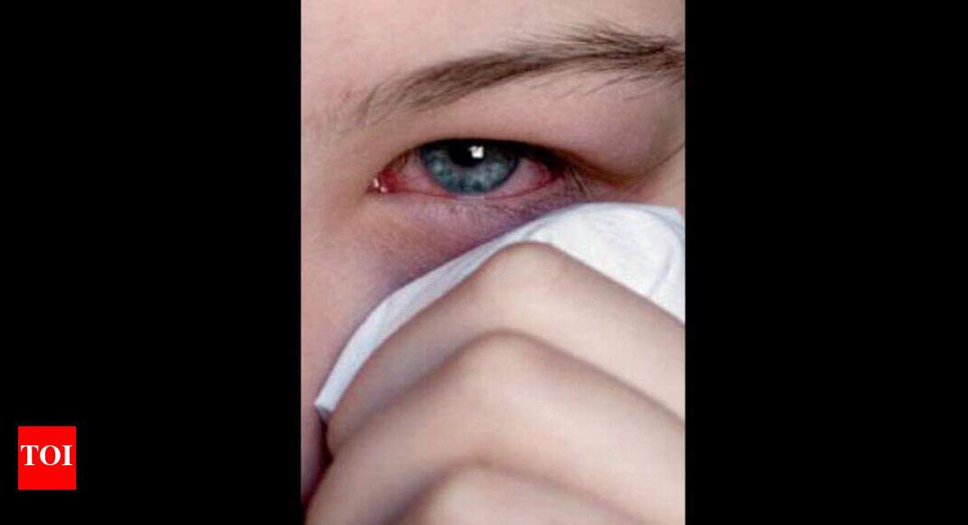 Sore eyes common visionbased indicator of Covid19, study finds