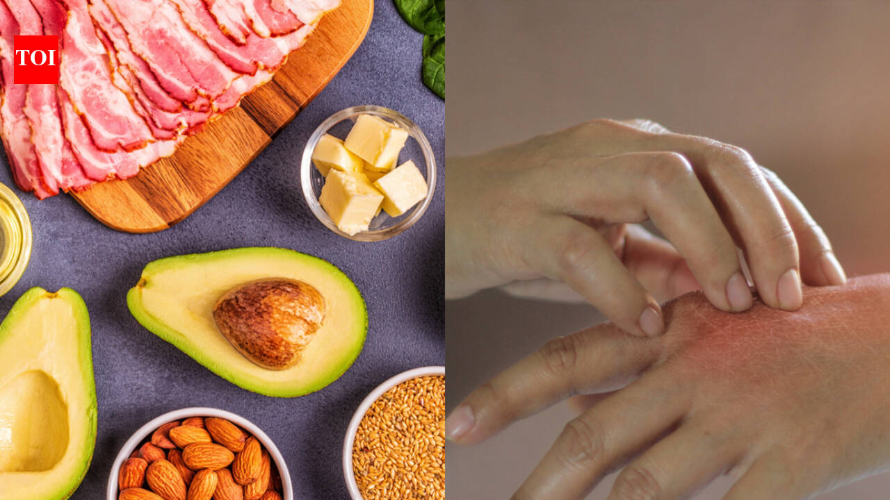 5 signs you are not eating enough fat